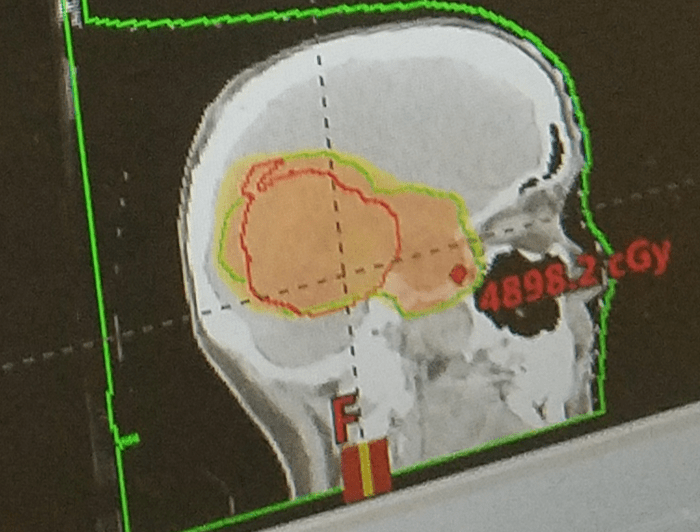 My Radiation Dose Cloud